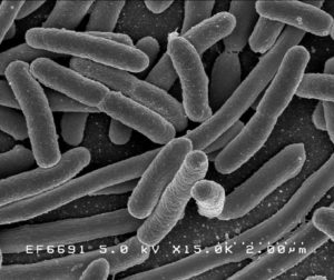 Bactéria E. coli vista no microscópio eletrônico.